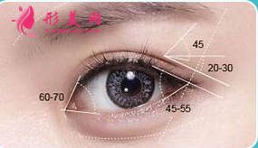 做開眼角手術(shù)后會(huì)回縮嗎