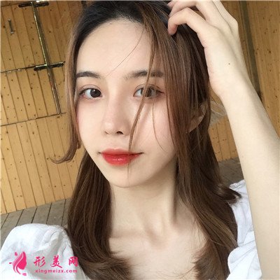 武漢眼綜合手術(shù)術(shù)后恢復(fù)情況分析 術(shù)后 武漢眼綜合手術(shù)術(shù)后恢復(fù)情況分析