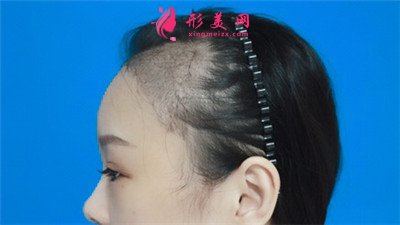 99cd1622c133-audio.jpg