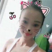 成都恒博植發(fā)發(fā)際線調(diào)整術(shù)后恢復(fù)效果對(duì)比