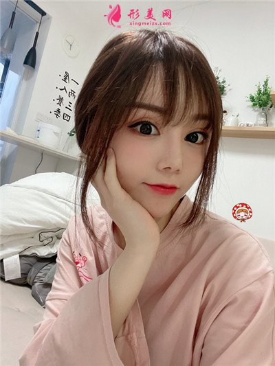 鄭州做M唇手術術后恢復效果反饋