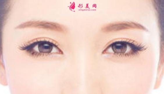 雙眼皮術(shù)后消腫護理方法