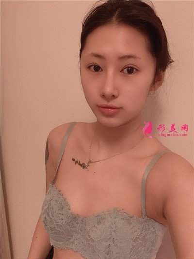 成都假體隆胸術(shù)后恢復(fù)情況對(duì)比分享
