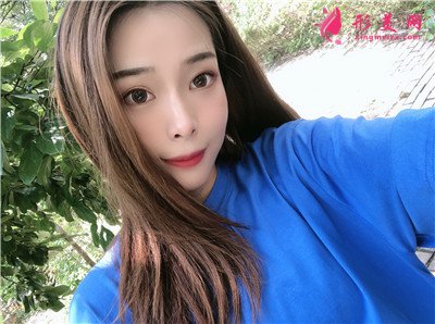 上海切開雙眼皮術(shù)后恢復(fù)情況反饋 術(shù)后 上海切開雙眼皮術(shù)后恢復(fù)情況反饋