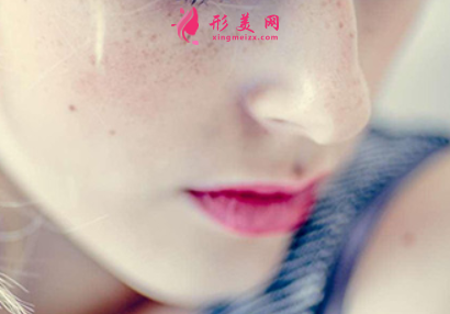 激光治療雀斑后的護(hù)理方法