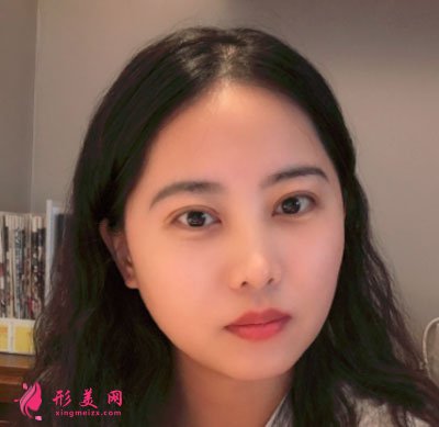 廈門美萊醫(yī)療美容醫(yī)院眼部多項案例