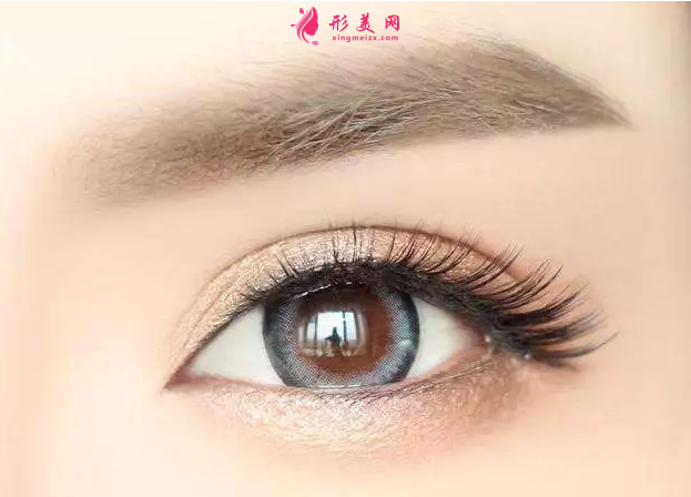 開眼角后多久可以戴隱形眼睛