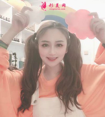 杭州瑞麗整形美容醫(yī)院隆鼻案例