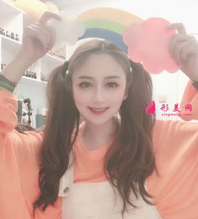 杭州瑞麗整形美容醫(yī)院隆鼻案例