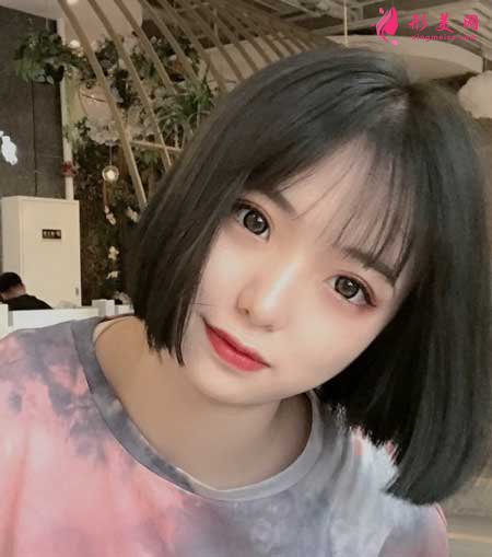 青島市中心醫(yī)院整形美容科做雙眼皮案例分享