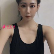 分享成都美萊醫(yī)院吳江山為我做的假體隆胸，從A到C的經(jīng)歷