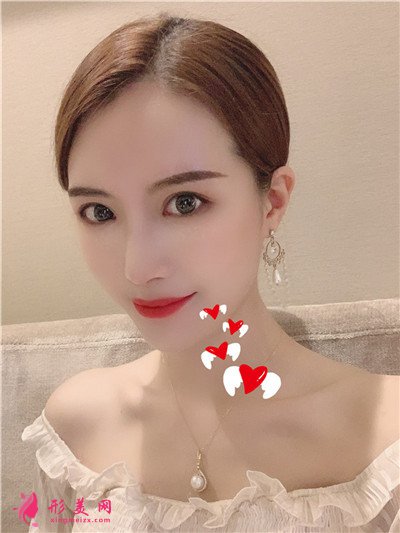 93f935773c15-audio.jpg