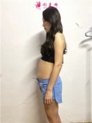 深圳富華醫(yī)療美容醫(yī)院腰腹吸脂術(shù)后恢復(fù)情況反饋