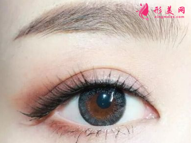 做開(kāi)眼角的注意事項(xiàng)