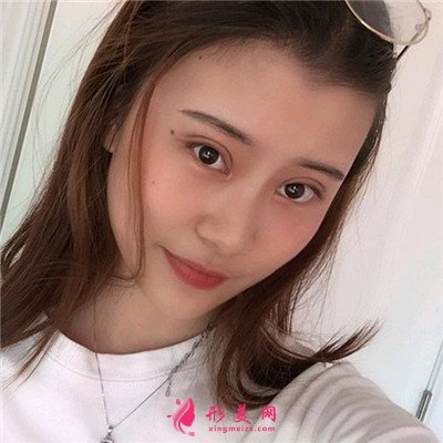 7f04a9729f22-audio.jpg