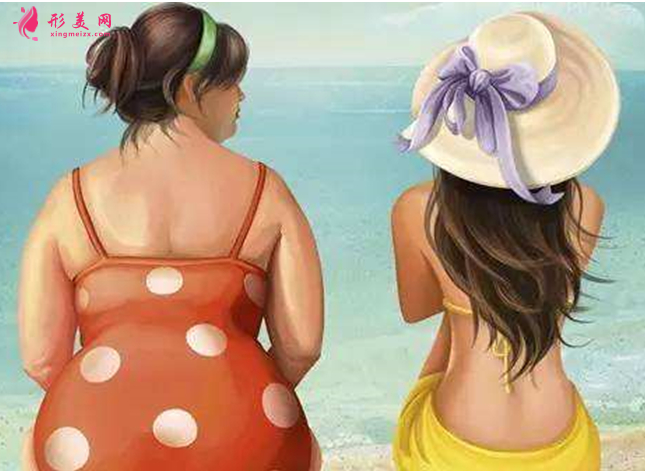吸脂減肥后如何護理