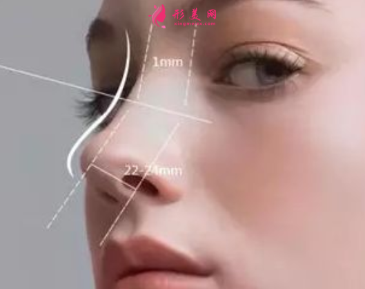 自體軟骨隆鼻的風險大不大
