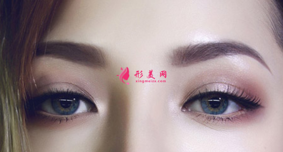 全切雙眼皮什么時候拆線比較好