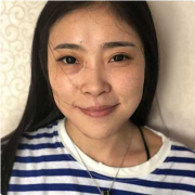 “自體肋軟骨隆鼻”真實案例分享還有術(shù)后效果對比圖展示哦~