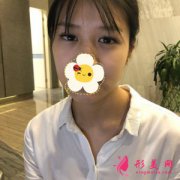 深圳富華醫(yī)療美容醫(yī)院雙眼皮案例 我都被自己驚艷了 變美捷徑
