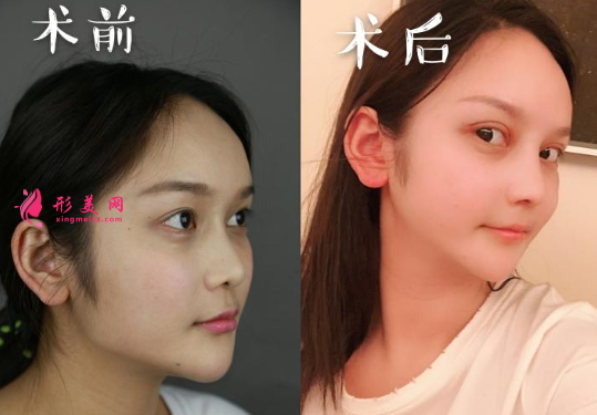 四川華美紫馨磨骨怎么樣，價(jià)格表曝光
