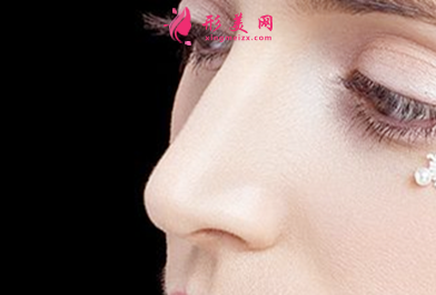 假體隆鼻什么時候要更換