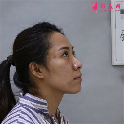66b547d430af-half.jpg 66b547d430af-half.jpg