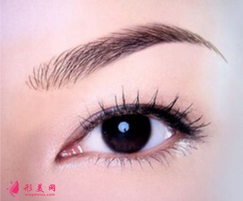 開(kāi)眼角后怎么護(hù)理