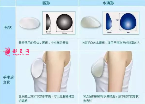 隆胸假體型號(hào)哪種比較好