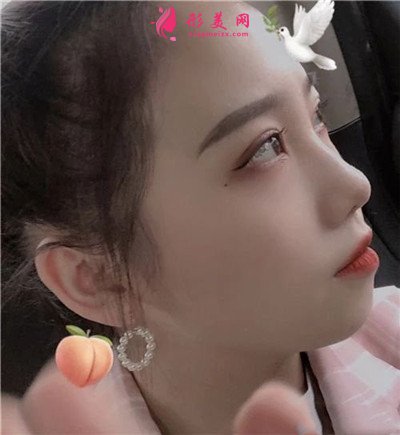 4acc2a800bfa-audio.jpg