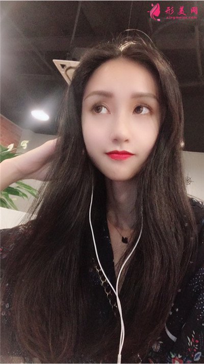 武漢發(fā)際線種植手術(shù)術(shù)后恢復(fù)效果分享 術(shù)后 武漢發(fā)際線種植手術(shù)術(shù)后恢復(fù)效果分享