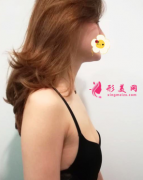 上海九院做假體隆胸后女人味十足 手感一級棒