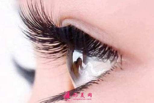 全切雙眼皮手術(shù)有哪些風(fēng)險(xiǎn)