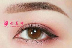 開眼角需要涂抹祛疤的藥膏嗎?