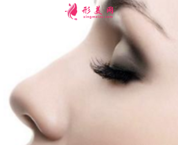 假體隆鼻后會(huì)晃動(dòng)嗎