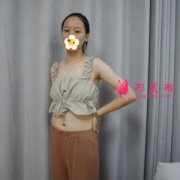 腰太粗了咋辦 西安葉子整形醫(yī)院腰腹吸脂讓我變身小蠻腰