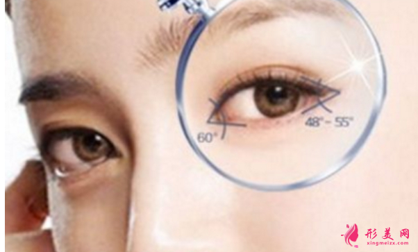 開眼角失敗了可以修復嗎