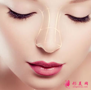 做軟骨隆鼻可以保持多久