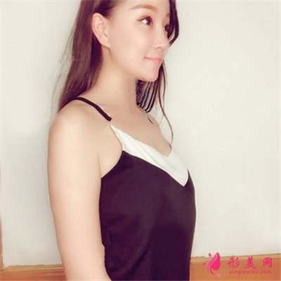 廈門假體隆胸術(shù)后恢復(fù)情況對比圖分享