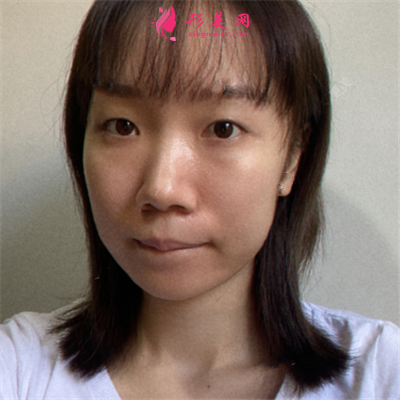 37571252b1e4-half.png 37571252b1e4-half.png