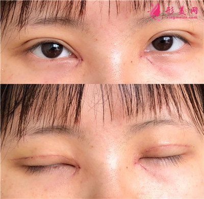 f0015ac6bd99-audio.jpg
