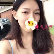 重慶軍美整形醫(yī)院切開雙眼皮案例 形狀很適合我 變成熟了