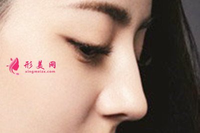 假體隆鼻哪里做得好
