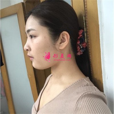 614bd38057c3-half.jpg 614bd38057c3-half.jpg
