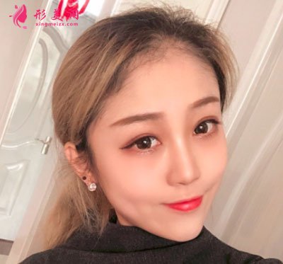 昆明美伊萊醫(yī)療美容鼻部多項案例