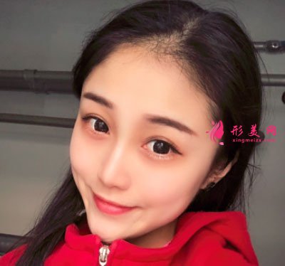 昆明美伊萊醫(yī)療美容鼻部多項案例