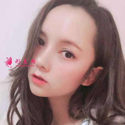 昆明韓辰醫(yī)療美容醫(yī)院鼻部多項案例
