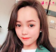 上海華美醫(yī)療美容鼻部多項案例分享|術后48天效果圖！
