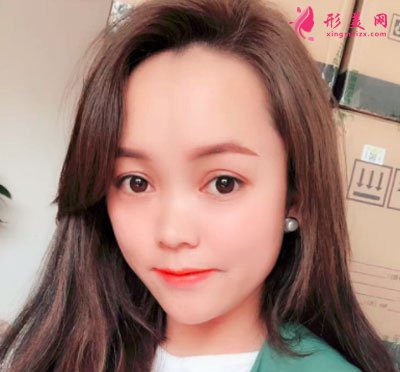 昆明韓辰醫(yī)療美容醫(yī)院鼻部多項案例