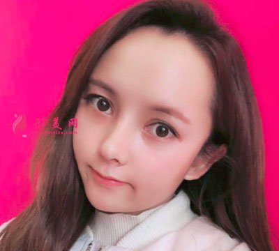 昆明韓辰醫(yī)療美容醫(yī)院鼻部多項案例